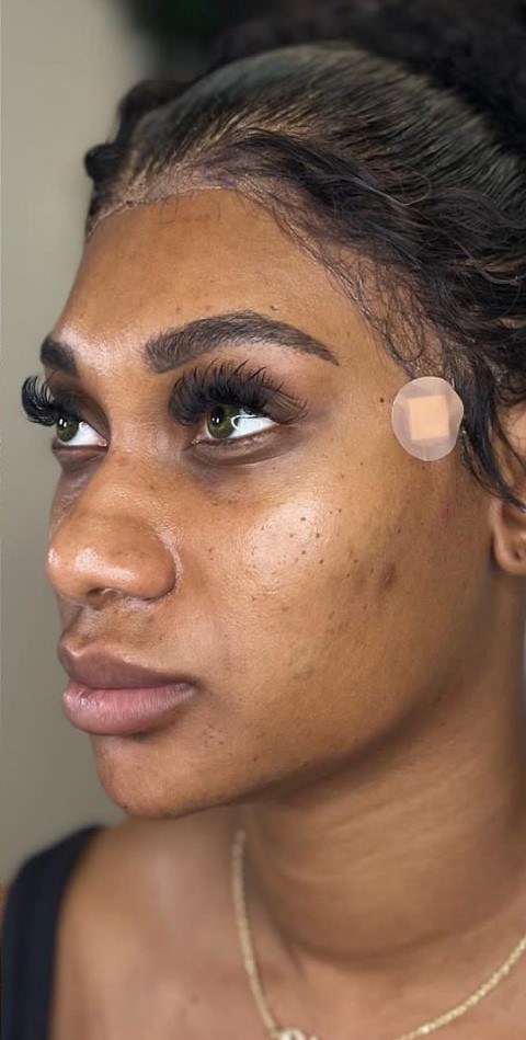 After Facial Balancing
